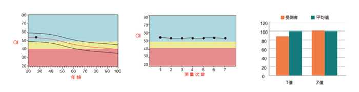 OSTEOKJ3000M国产跟骨骨密度分析仪